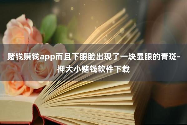 赌钱赚钱app而且下眼睑出现了一块显眼的青斑-押大小赌钱软件下载